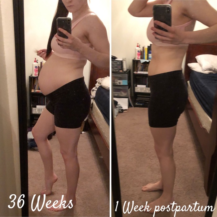 Photo of 36 weeks pregnant compared to 1 week postpartum
